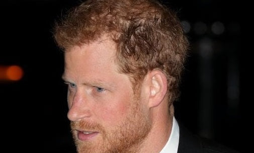 Prince Harry's Hair Through The Years